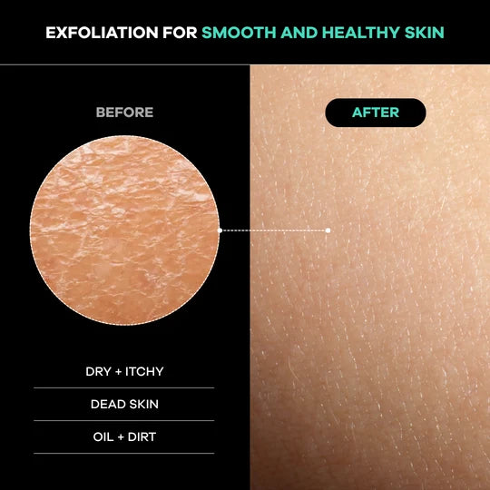 Dermasuri Deep Exfoliating Back Scrub