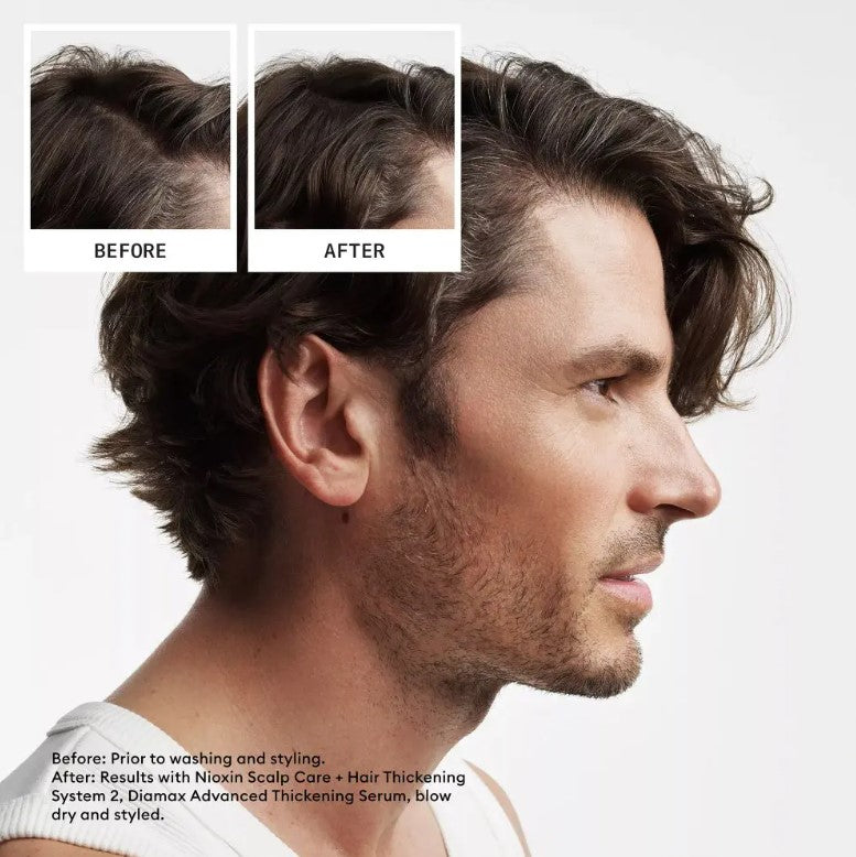 Nioxin System 2 Shampoo & Conditioner Duo 33.8 oz. Nioxin