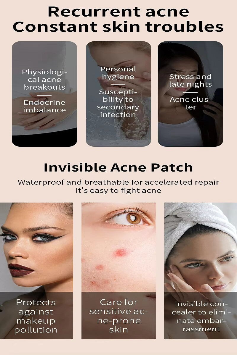 Acne Patch Original Pimple Patch - 36 Count PinkPro Beauty Supply