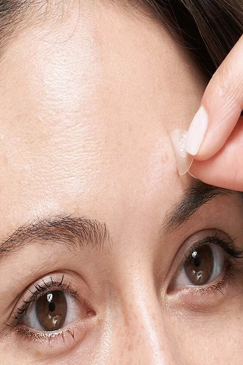 Acne Patch Original Pimple Patch - 36 Count PinkPro Beauty Supply