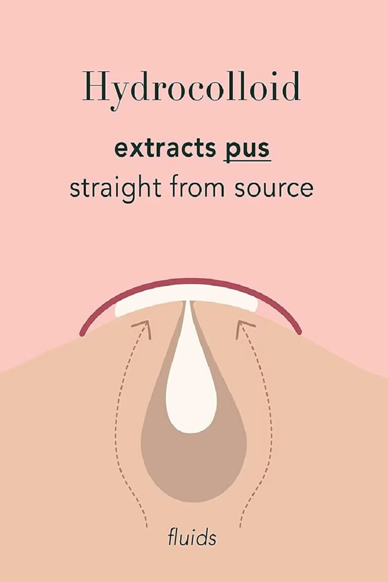 Acne Patch Original Pimple Patch - 36 Count PinkPro Beauty Supply