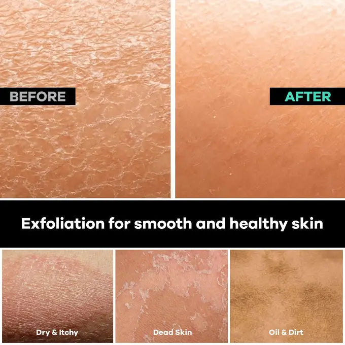 Dermasuri Deep Exfoliating Back Scrub Dermasuri
