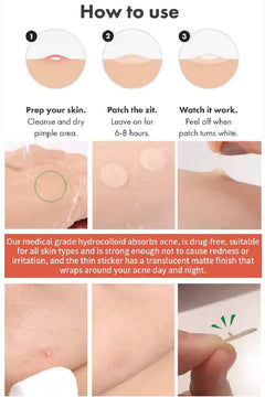 Acne Patch Original Pimple Patch - 36 Count PinkPro Beauty Supply