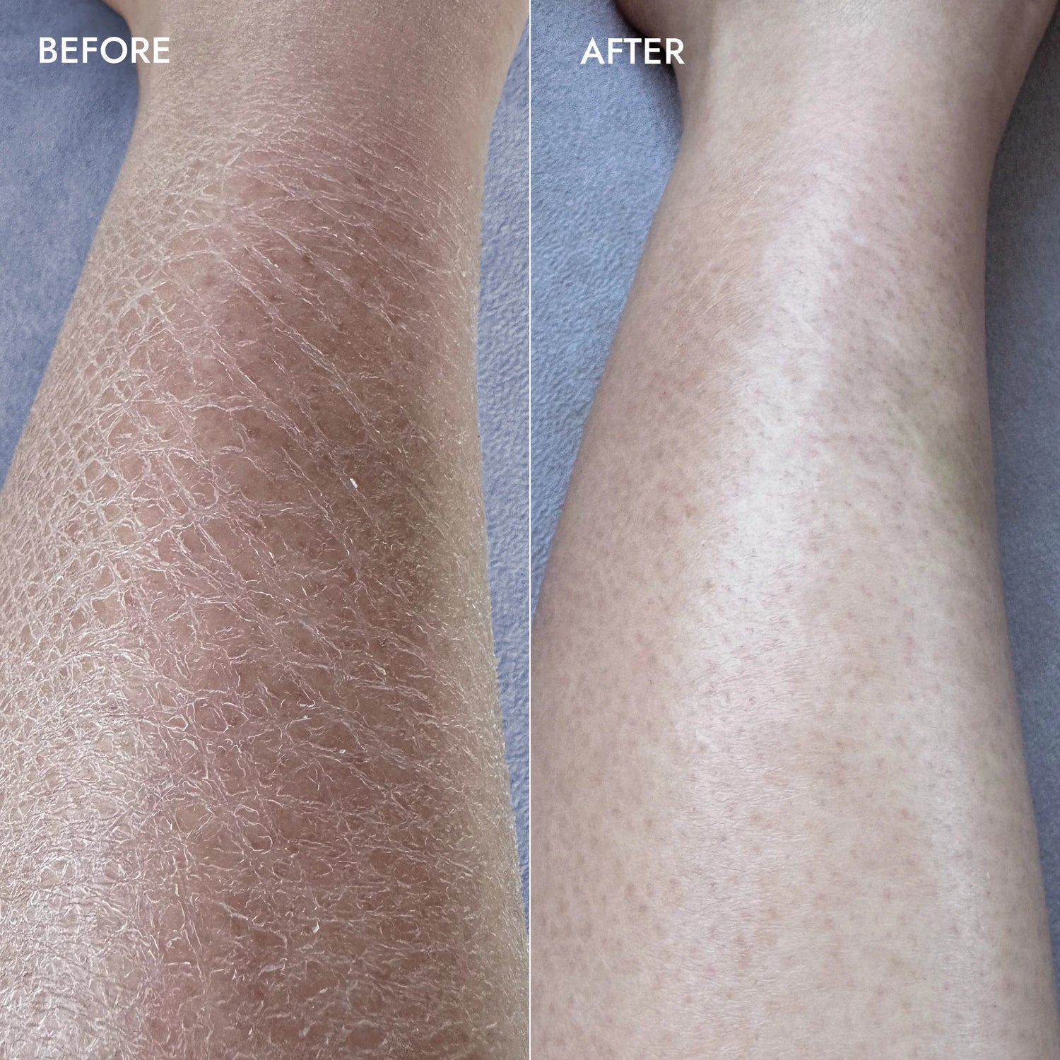 Voesh Exfoliating Body Wash Hinoki & Lavanda - Sugar Scrub with Plant-Derived AHAs - 6.2 oz.